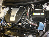 Thumbnail for Injen 13 Hyundai Veloster Turbo 1.6L 4cyl Black Short Ram Intake